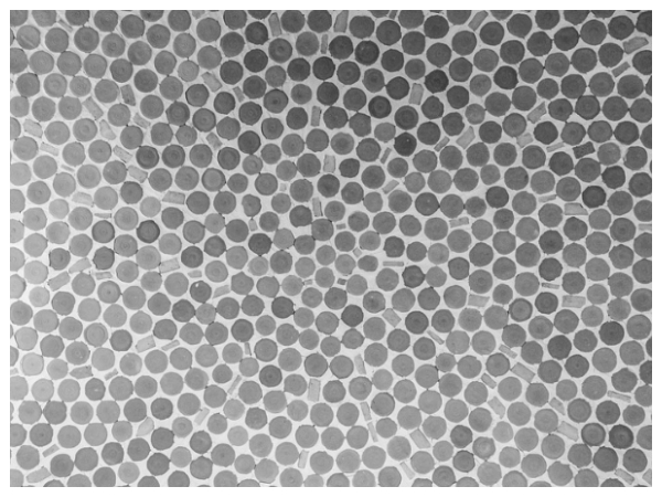 புள்ளி புள்ளியாக தெரிகிறதா..?