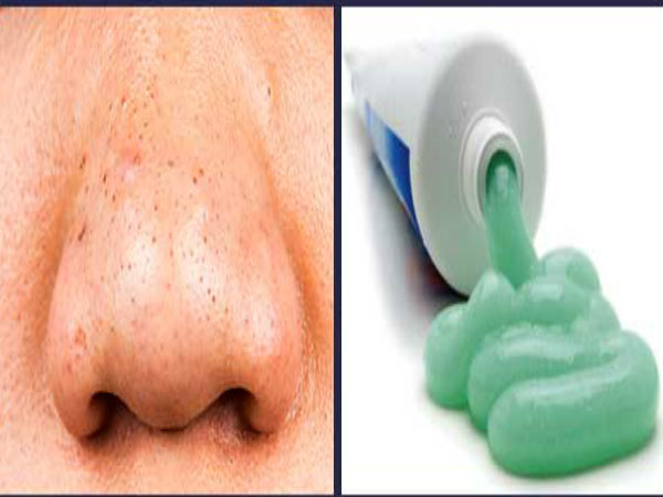 நடிகைகள் சர்ஜரி