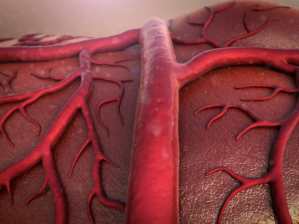 வீக்கத்தை குறைக்க 