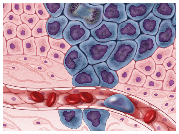 சர்க்கரையும் புற்றுநோயும்!