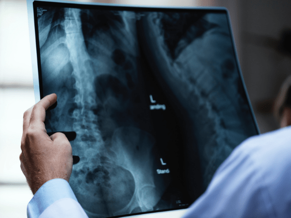 பரிசோதனை