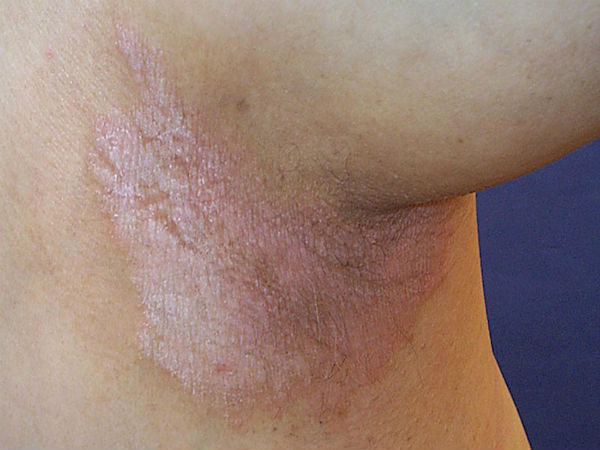 இதர காரணங்கள் 