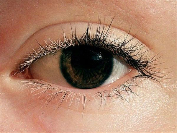 அறிகுறிகள்