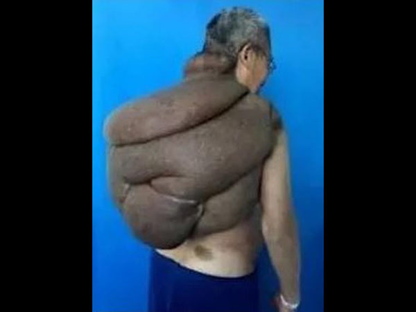 அதிர்ச்சி அளிக்கும் இந்த நிலையின் புகைப்படங்கள்