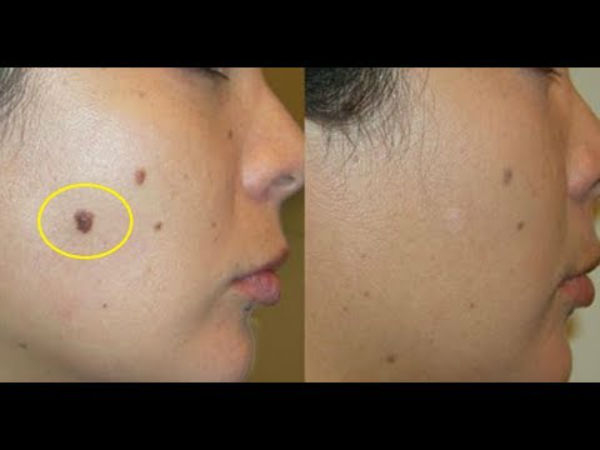 புள்ளிகள் 