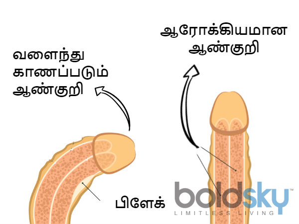 எத்தனை இன்ஞ்