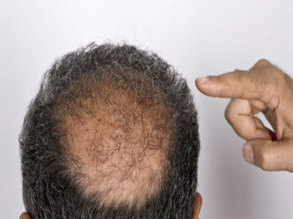 நோயெதிர்ப்பு சக்தி 