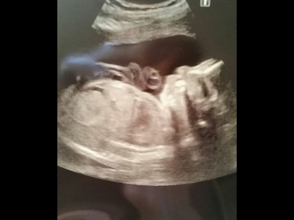 ஊட்டச்சத்துக்கள்