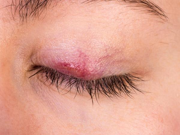 உண்டாகக் காரணம் 