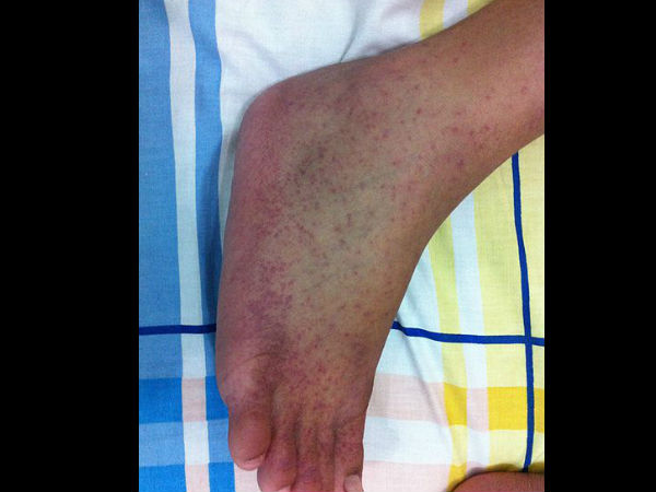 பாதிப்புகள்