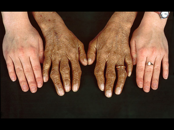 சிகிச்சைகள் 