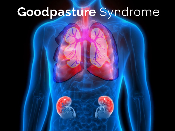 தொடர்ந்து இருமல் இருந்தால் அதனை கவனிக்கவும்