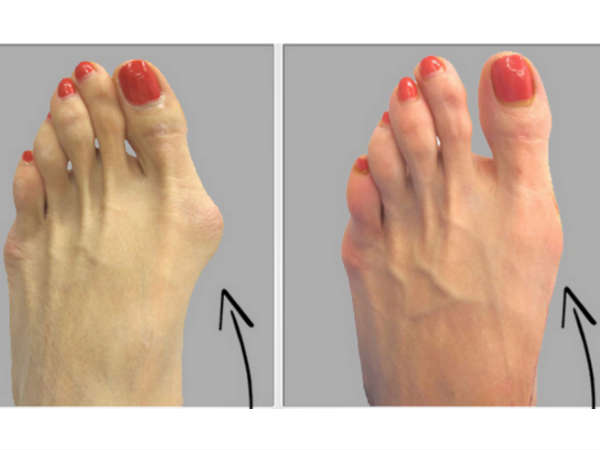 அறிகுறிகள் 