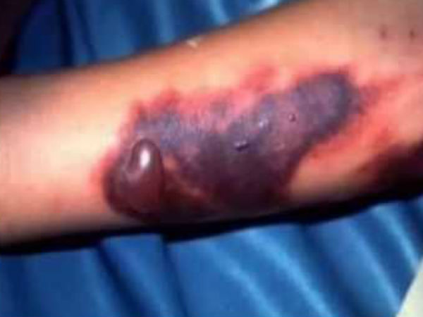 எல்லை மூடல்கள் இல்லை