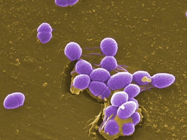 தடுக்கும் வழிகள் 