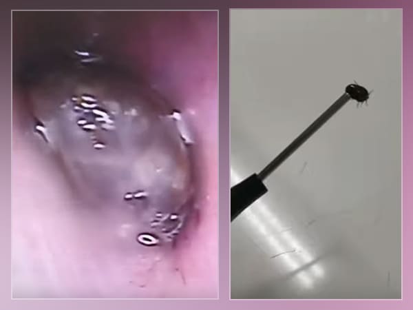 இதன் பின்னணி