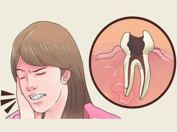 சாதாரண சளி: சாதாரண சளி: