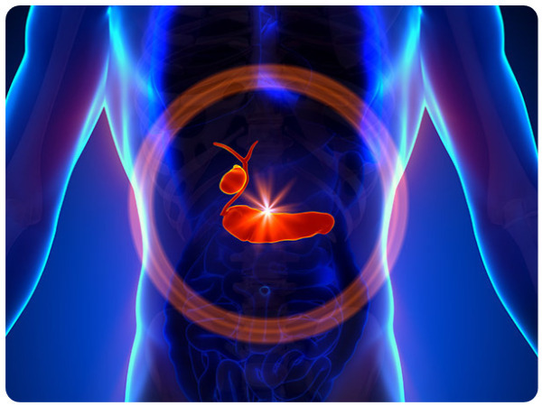 கடுமையான கணைய அழற்சி