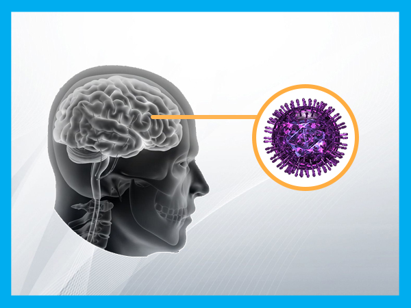 ஜப்பானிய என்செபாலிடிஸ்