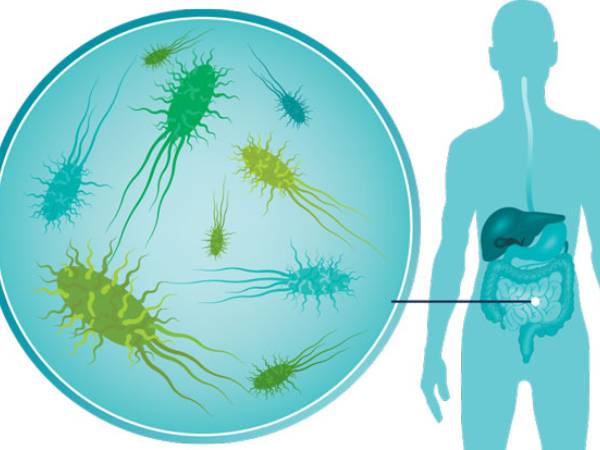 Good Bacteria Are Essential For Gut Health, Here Are 5 Ways To Increase Them Good Bacteria Are Essential For Gut Health, Here Are 5 Ways To Increase Them