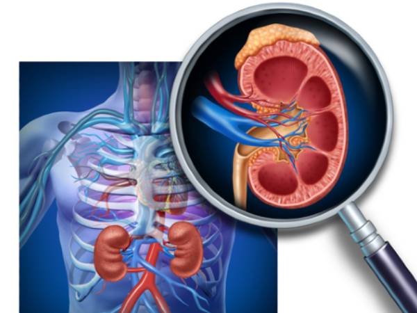 Risk Factors For Kidney Cancer Risk Factors For Kidney Cancer
