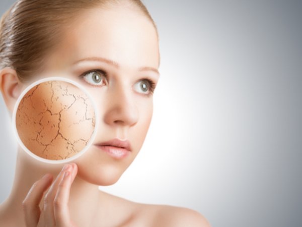 வறட்சியான சருமம்