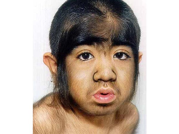 குரங்கைப் போல முடி வளரும்