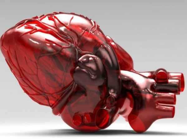 வென்ட்ரிகுலர் செப்டல் குறைபாடு