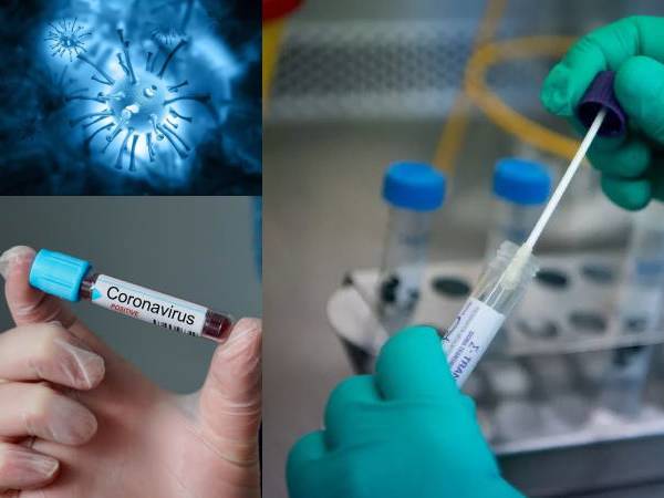 Coronavirus Test: Getting Tested For COVID-19? Keep These Things In Mind Coronavirus Test: Getting Tested For COVID-19? Keep These Things In Mind