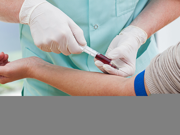 கார்டிசோல் அளவை அளவிட இரத்த பரிசோதனை கார்டிசோல் அளவை அளவிட இரத்த பரிசோதனை