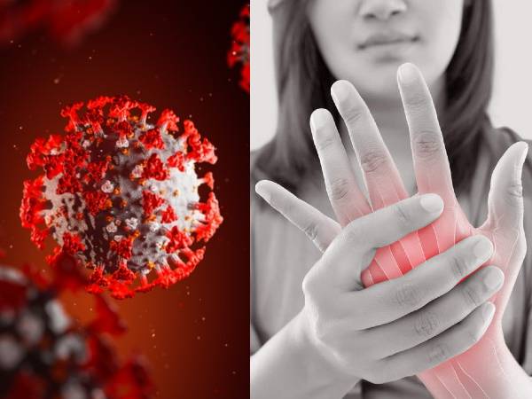 Arthritis Patients Too May Suffer Severe COVID-19 Complications Arthritis Patients Too May Suffer Severe COVID-19 Complications