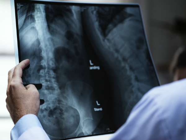 பேரியம் எக்ஸ்ரே