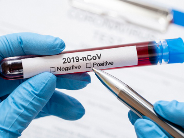 Asymptomatic COVID-19 Management: Home Care Tips For Patients With No Or Very Mild Symptoms Asymptomatic COVID-19 Management: Home Care Tips For Patients With No Or Very Mild Symptoms