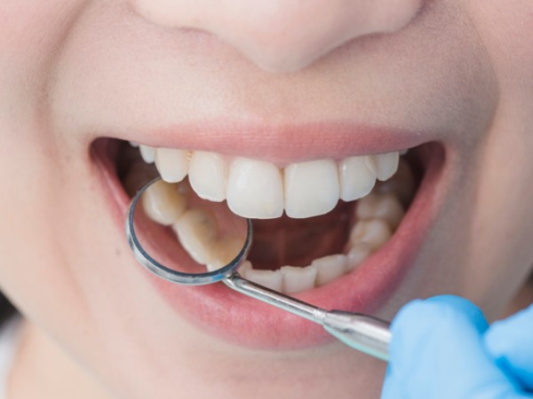 ஸ்கர்விக்கு சிகிச்சையளிக்கலாம்