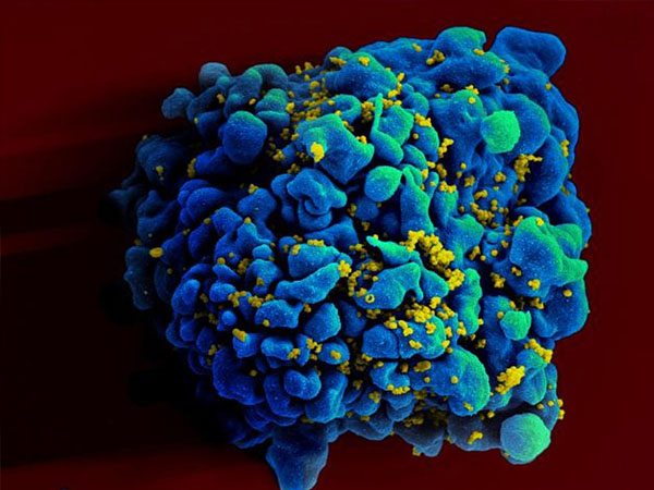 சப்பரே வைரஸ் என்ற பெயர் எவ்வாறு வந்தது?