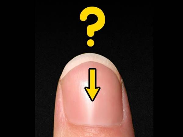 பிறை எதுவும் தெரியவில்லையா?