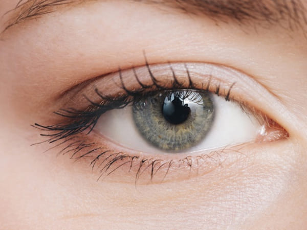 தீவிர மூடிய கோண கண் அழுத்த நோய் (Acute Angle-Closure Glaucoma)