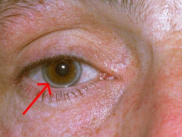 நீல நிற வளையம்