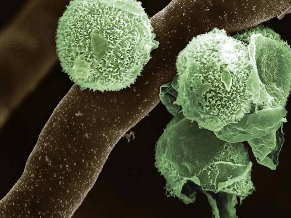 இந்தியாவின் முதல் பச்சை பூஞ்சை வழக்கு