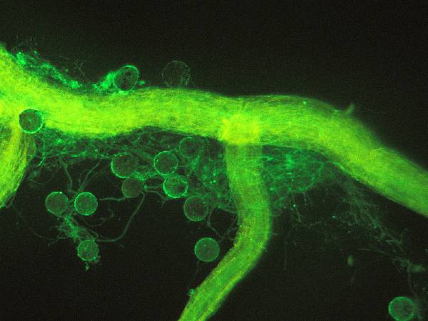 பச்சை பூஞ்சை அல்லது அஸ்பெர்கிலஸின் வகைகள் என்ன?