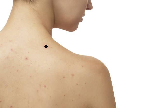 தோள்பட்டை