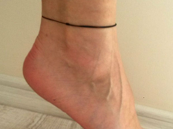 காயங்களைக் குணப்படுத்தும்