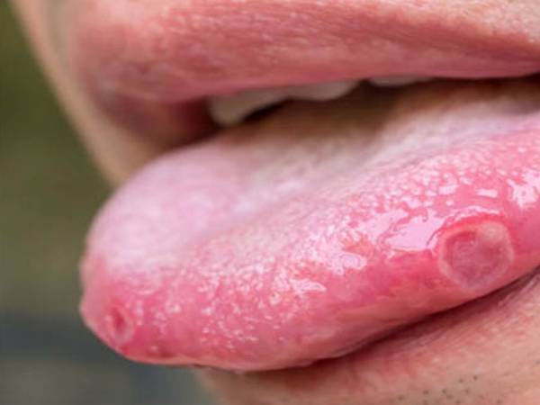 காயங்கள்