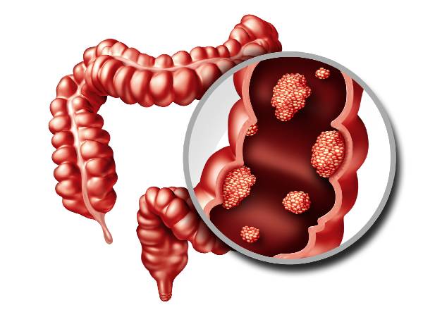 இறுதிகுறிப்பு