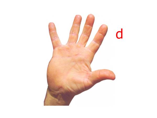 கடினமான உள்ளங்கை