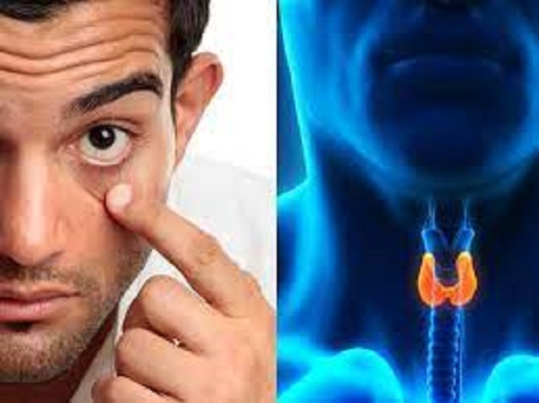 Thyroid eyes: Know what causes it and how to spot it in tamil Thyroid eyes: Know what causes it and how to spot it in tamil