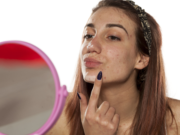 முகப்பரு அல்லது அரிப்பு