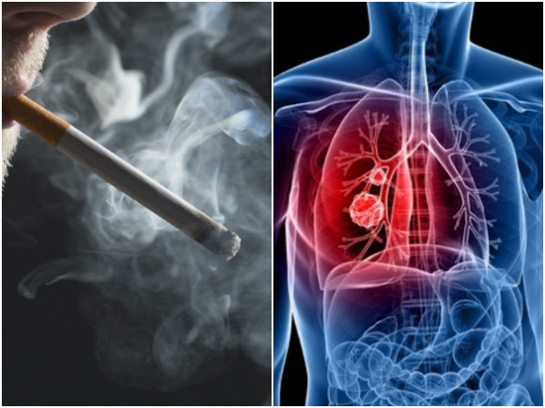 புகைப்பிடித்தலுக்கும், நுரையீரல் புற்றுநோய்க்கும் உள்ள தொடா்பு புகைப்பிடித்தலுக்கும், நுரையீரல் புற்றுநோய்க்கும் உள்ள தொடா்பு