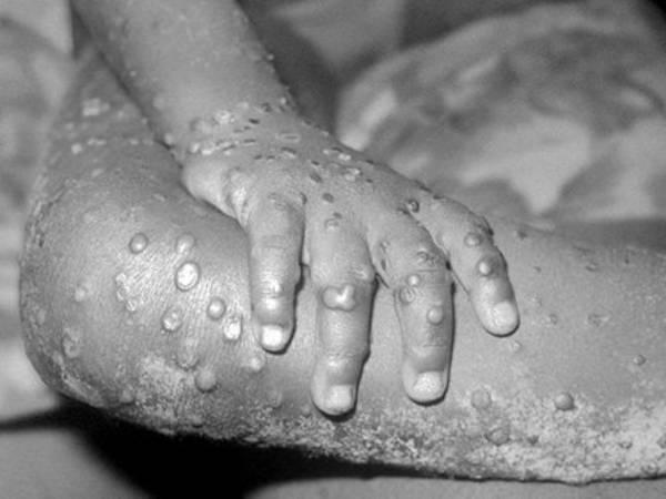 இறுதியாக