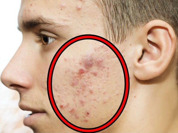 எந்தெந்த பகுதிகளில் இது பெரும்பாலும் நிகழ்கிறது?